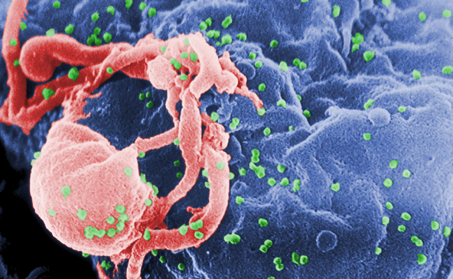 HIV